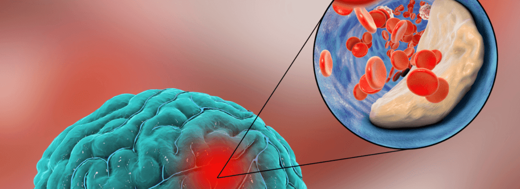 🩸presión arterial y diabetes, peligro silencioso🤫 - -
