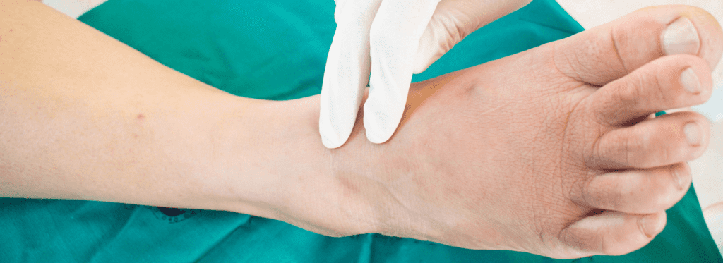 Diabetic foot care at home,🔺daily routine! - -