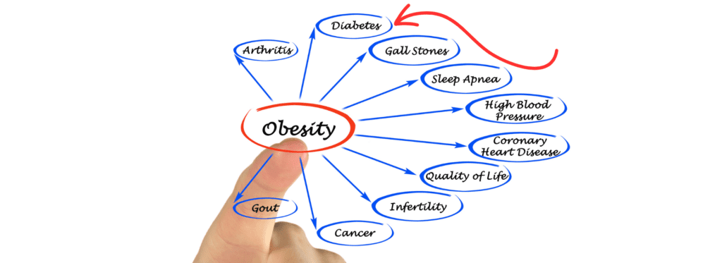 Obesity and diabetes type 2 🆘 why are we getting sick❓ - -