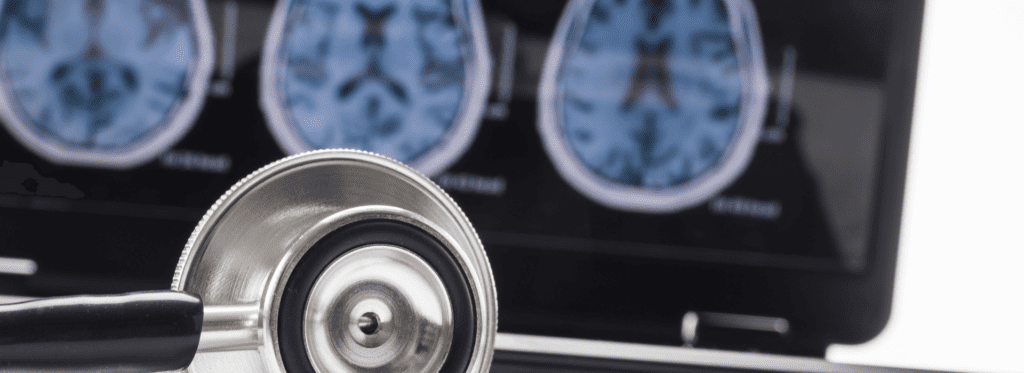 🍭 el azúcar alta y el cerebro, 😮 una bomba de tiempo! - -